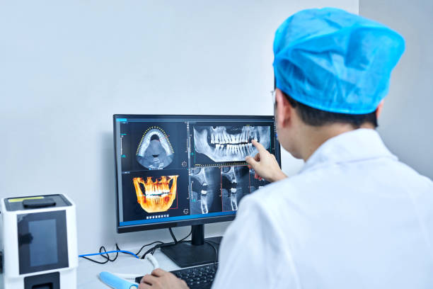 Best Emergency Tooth Extraction in Zephyrhills West, FL